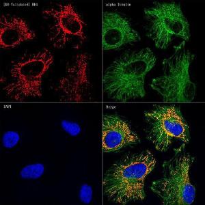 Anti-Hexokinase 1 Rabbit Monoclonal Antibody [clone: ARC0256]