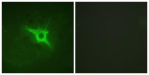 Anti-NCF1 Rabbit Polyclonal Antibody