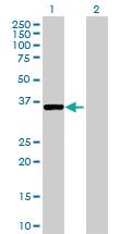 Anti-PKDCC Mouse Polyclonal Antibody