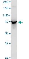 Anti-EPC1 Mouse Polyclonal Antibody