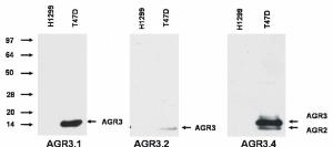 Anti-AGR3 Mouse Monoclonal Antibody [Clone: AGR3.1]