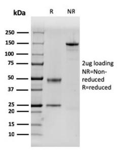 SDS-PAGE analysis of Anti-Dystrophin Antibody [DMD/3243] under non-reduced and reduced conditions; showing intact IgG and intact heavy and light chains, respectively. SDS-PAGE analysis confirms the integrity and purity of the antibody.