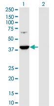 Anti-PRPSAP1 Mouse Monoclonal Antibody [clone: 5H10]