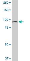 Anti-MTSS1 Mouse Monoclonal Antibody [clone: 2G9]