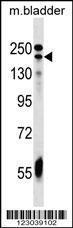 Anti-ADCY9 Rabbit Polyclonal Antibody (Biotin)