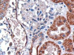 Anti-ACKR1 Antibody (A82945) (3µg/ml) staining of paraffin embedded Human Kidney. Microwaved antigen retrieval with citrate buffer pH 6, HRP-staining.