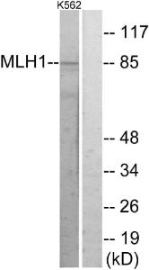 Western blot analysis of lysates from K562 cells using Anti-MLH1 Antibody. The right hand lane represents a negative control, where the antibody is blocked by the immunising peptide