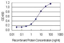 Anti-PRPSAP1 Mouse Monoclonal Antibody [clone: 5H10]