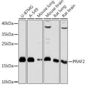 Western blot analysis of extracts of various cell lines, using Anti-JM4 / PRAF2 Antibody (A307754) at 1:1,000 dilution. The secondary antibody was Goat Anti-Rabbit IgG H&L Antibody (HRP) at 1:10,000 dilution.