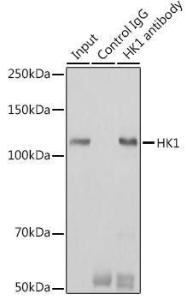 Anti-Hexokinase 1 Rabbit Monoclonal Antibody [clone: ARC0256]