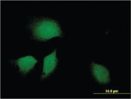 Anti-DNAJB9 Mouse Monoclonal Antibody [clone: 3G4]