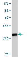 Anti-ZIC4 Mouse Monoclonal Antibody [clone: 3H6]