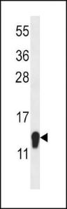 Anti-SZRD1 Rabbit Polyclonal Antibody (Biotin)