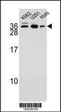 Anti-AMN1 Rabbit Polyclonal Antibody (HRP (Horseradish Peroxidase))