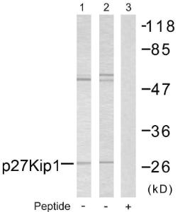 Western blot analysis of lysates from A2780 cells using Anti-p27 Kip1 Antibody The right hand lane represents a negative control, where the antibody is blocked by the immunising peptide