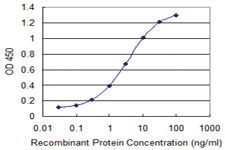 Anti-A1BG Mouse Monoclonal Antibody [clone: 1H1]