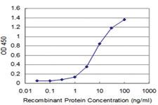 Anti-DLX5 Mouse Monoclonal Antibody [clone: 4B7]