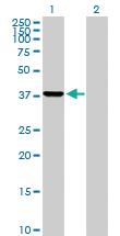 Anti-PRPSAP2 Mouse Polyclonal Antibody