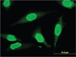 Anti-THAP11 Mouse Monoclonal Antibody [clone: 3C11]