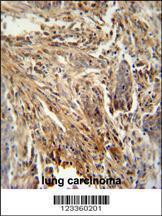 Anti-CSF2 Rabbit Polyclonal Antibody (FITC (Fluorescein Isothiocyanate))