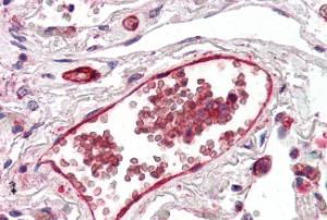 Anti-ACKR1 Antibody (A82945) (5µg/ml) staining of paraffin embedded Human Lung. Microwaved antigen retrieval with citrate buffer pH 6, AP-staining.