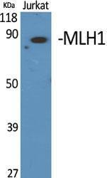 Western blot analysis of various cells using Anti-MLH1 Antibody