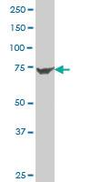 Anti-EPC1 Mouse Polyclonal Antibody