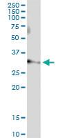 Anti-ARTC4, CD297, DO, DOK1 Polyclonal Antibody Pair