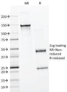 SDS-PAGE analysis of Anti-BrdU Antibody [BRD494] under non-reduced and reduced conditions; showing intact IgG and intact heavy and light chains, respectively. SDS-PAGE analysis confirms the integrity and purity of the antibody