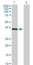 Anti-MDH1 Rabbit Polyclonal Antibody