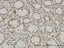 Anti-MTSS1 Mouse Monoclonal Antibody [clone: 2G9]