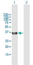 Anti-COL23A1 Mouse Polyclonal Antibody