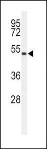 Anti-ASMT Rabbit Polyclonal Antibody (AP (Alkaline Phosphatase))