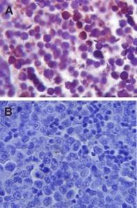 Immunohistochemistry analysis of mouse spleen tissue. The Primary Antibody used was Anti-TLR4 Antibody (A304918) at 1:100.