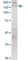 Anti-COL1A1 Mouse Monoclonal Antibody [clone: 3G3]