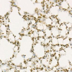 Immunohistochemistry analysis of paraffin-embedded mouse lung using Anti-Wee1 Antibody [ARC57004] (A307755) at a dilution of 1:100(40x lens). Perform high pressure antigen retrieval with 10 mM citrate buffer pH 6.0 before commencing with IHC staining protocol.