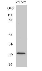 Western blot analysis of various cells using Anti-p27 Kip1 Antibody