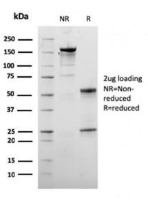 SDS-PAGE analysis of Anti-Dystrophin Antibody [DMD/3245] under non-reduced and reduced conditions; showing intact IgG and intact heavy and light chains, respectively. SDS-PAGE analysis confirms the integrity and purity of the antibody.