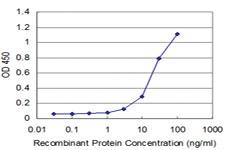 Anti-DLX5 Mouse Monoclonal Antibody [clone: 2B6]