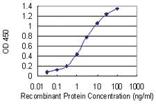 Anti-MTSS1 Mouse Monoclonal Antibody [clone: 2G9]