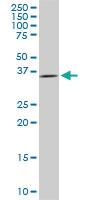 Anti-DCPS Mouse Monoclonal Antibody [clone: 3E5]