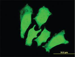 Anti-TNNI3 Mouse Monoclonal Antibody [clone: 1E7]