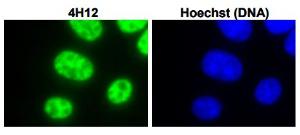 Anti-U1-C antibody