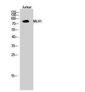 Western blot analysis of Jurkat cells using Anti-MLH1 Antibody