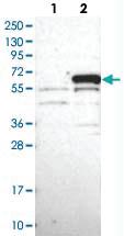 Anti-MPP6 Rabbit Polyclonal Antibody