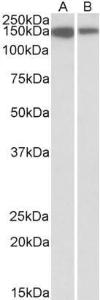 Anti-MCF2L Antibody (A82947) (1 µg/ml) staining of Jurkat (A) and Human Thymus (B) lysates (35 µg protein in RIPA buffer) Primary incubation was 1 hour Detected by chemiluminescence