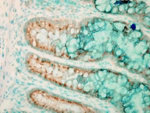 Immunohistochemistry analysis of mouse colon colitis, fixed in formali