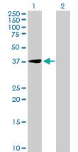 Anti-EIF2B2 Rabbit Polyclonal Antibody