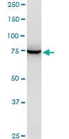 Anti-EPC1 Mouse Polyclonal Antibody