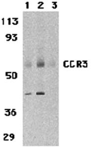 Western blot analysis of CCR3 in human spleen tissue lysates with CCR3 antibody at 1 (lane 1) and 2 &#956;g/mL (lane 2), and 2 &#956;g/mL in the presence of blocking peptide. (1109P) (lane 3).